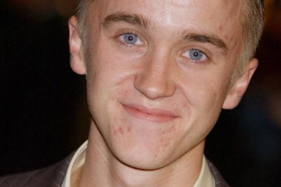 Tom Felton de "Harry Potter" !